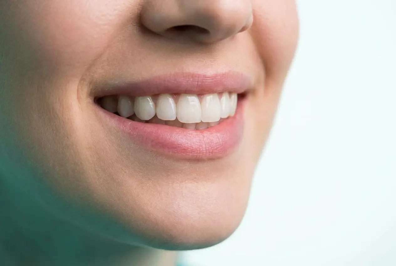 Natural-looking porcelain veneers smile